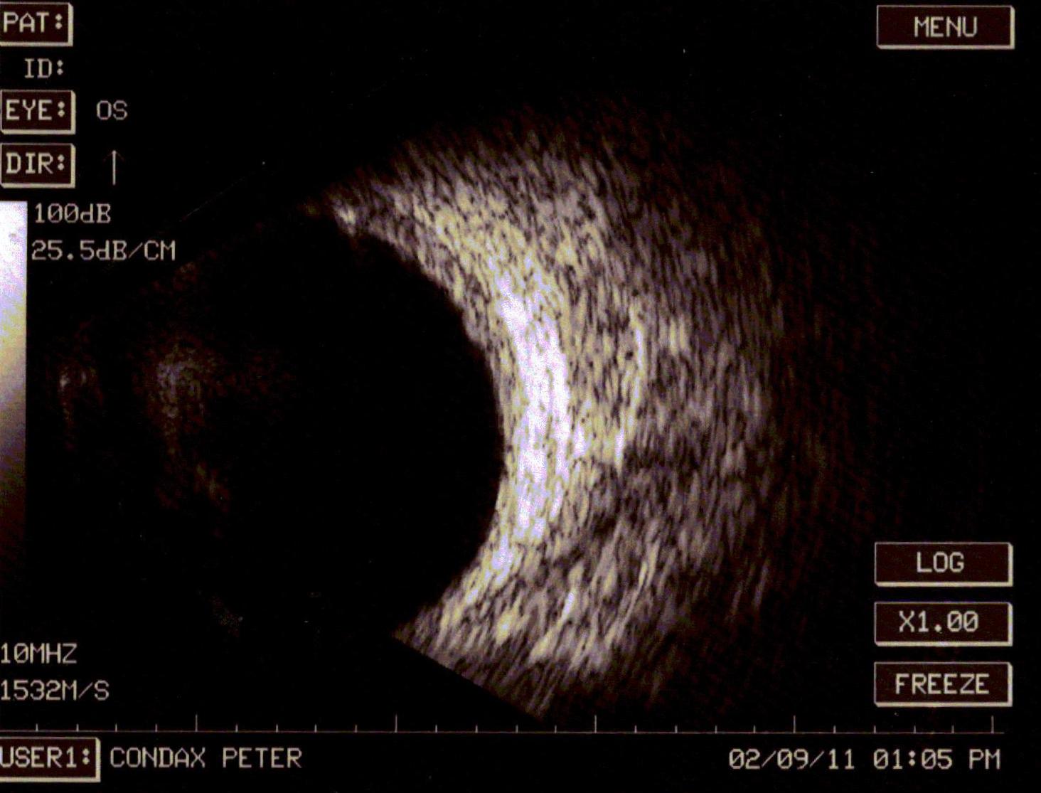 Ophthalmic Diagnostic Imaging